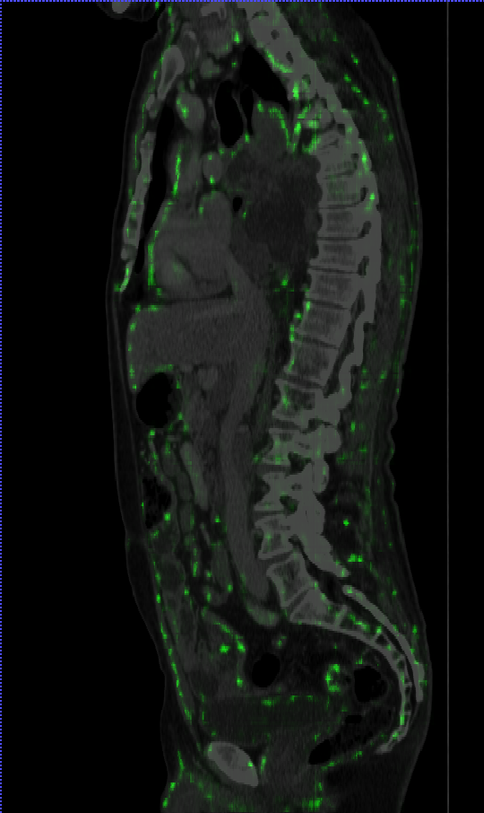 SP3D Representation Map